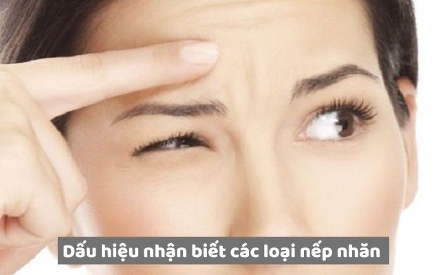 Dấu hiệu nhận biết các loại nếp nhăn trên mặt