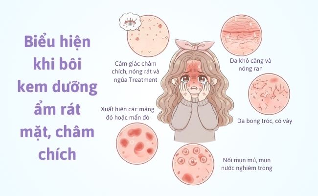 Biểu hiện khi bôi kem dưỡng ẩm rát mặt, châm chích
