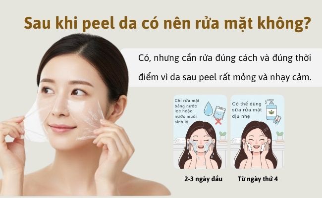 Sau khi peel da có nên rửa mặt không?