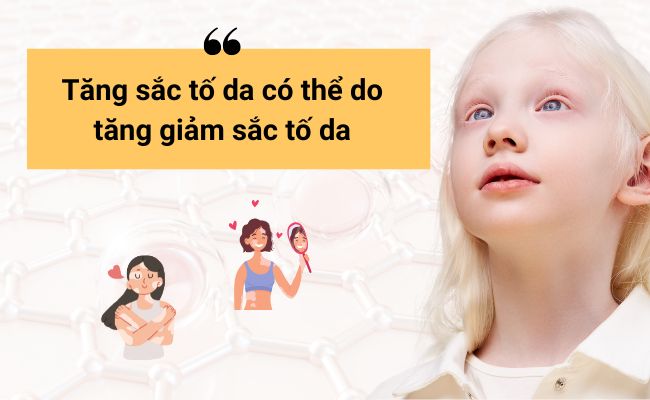 Bệnh liên quan giảm sắc tố da