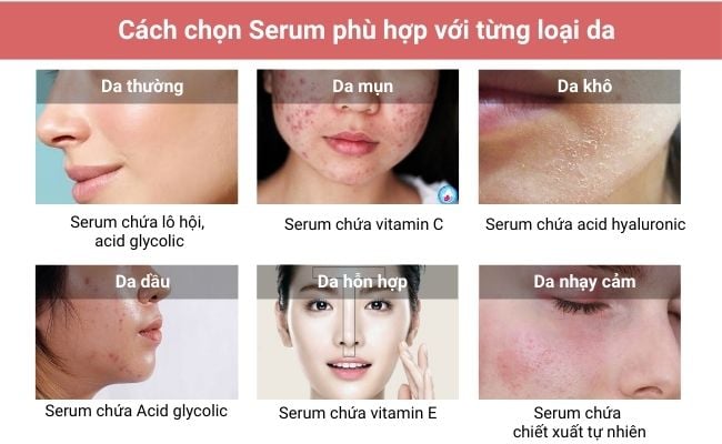 Cách lựa chọn serum phù hợp với da
