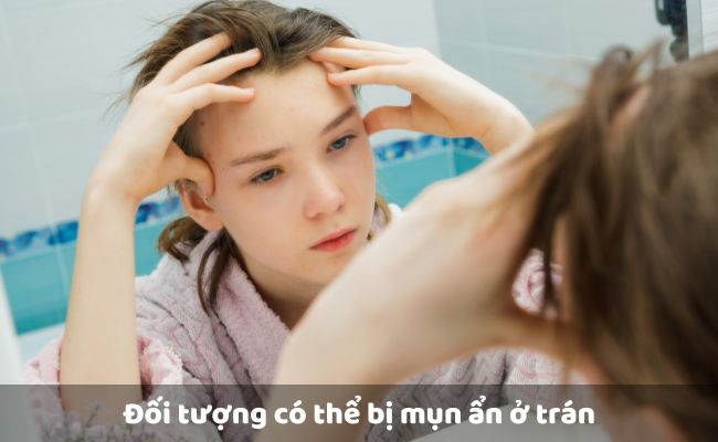 Đối tượng có thể bị mụn ẩn ở trán