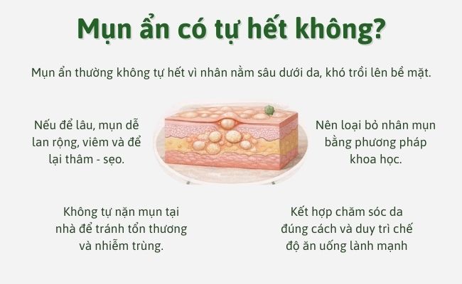 Mụn ẩn có tự hết không?