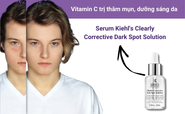 Serum Clearly Corrective Dark Spot Solution Vitamin C cải thiện làn da không còn thâm mụn