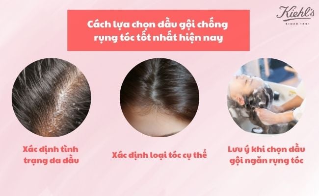 Cách lựa chọn dầu gội chống rụng tóc tốt nhất hiện nay
