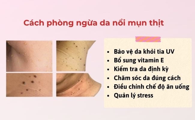 Cách phòng ngừa da nổi mụn thịt
