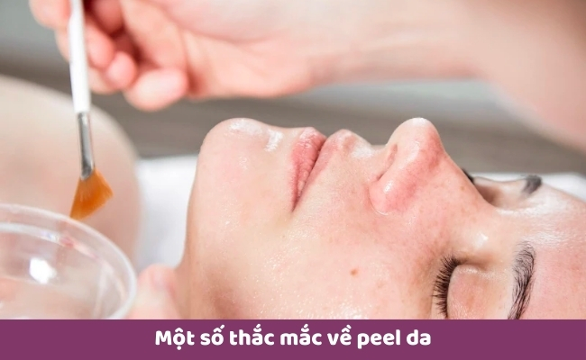 Cách chăm sóc da sau peel hạn chế gây mỏng da