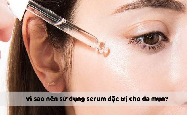 Vì sao nên sử dụng serum đặc trị cho da mụn?