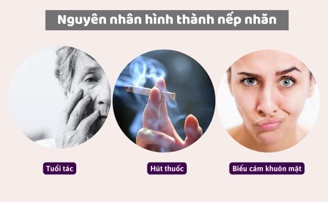 Nguyên nhân hình thành nếp nhăn trên mặt