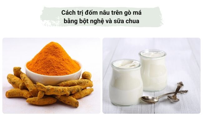 Cách trị đốm nâu trên gò má bằng bột nghệ và sữa chua