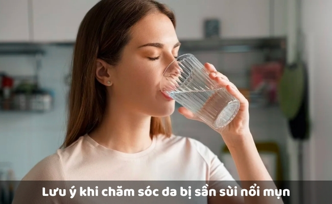 Lưu ý khi chăm sóc da bị sần sùi nổi mụn