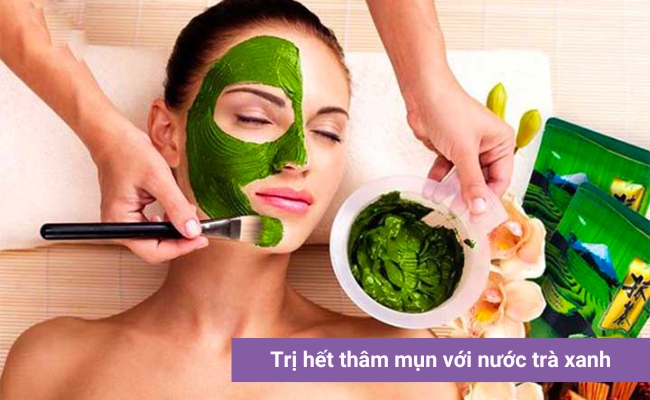 Bí quyết hết thâm mụn tự nhiên từ lá trà xanh giúp giảm thâm, kháng khuẩn tuyệt vời