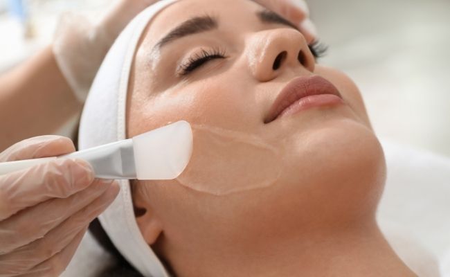 Peel da hóa học trị mụn đầu đen