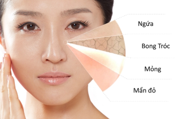 Cách nhận biết da nhạy cảm Nhận biết da nhạy cảm