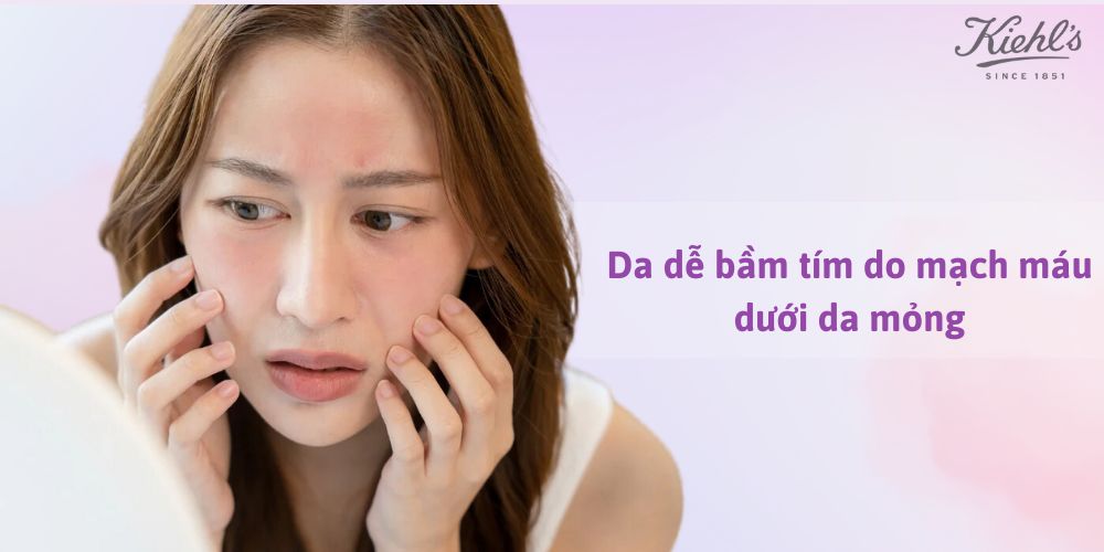 14 dấu hiệu lão hóa da thường gặp