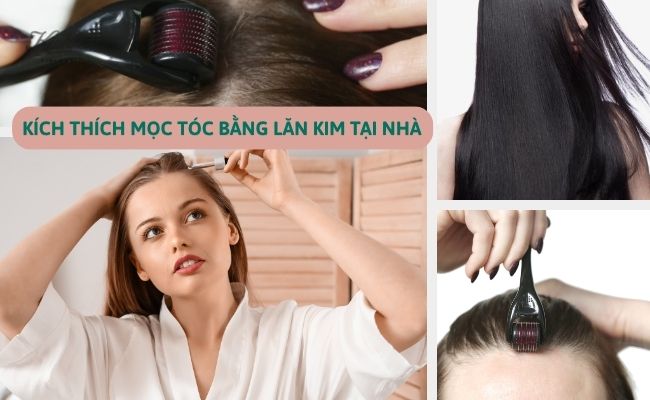 15 Cách mọc tóc nhanh tại nhà trong 1 tuần