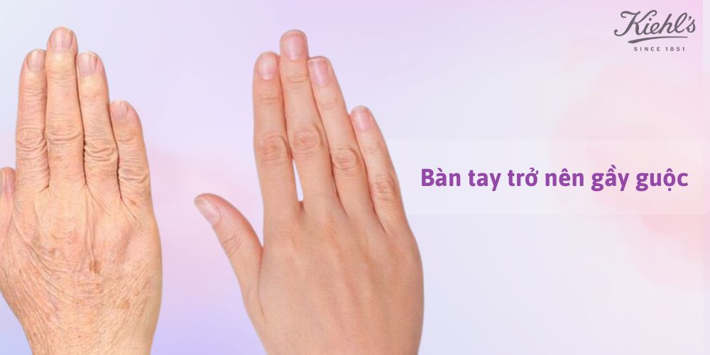 14 dấu hiệu lão hóa da thường gặp