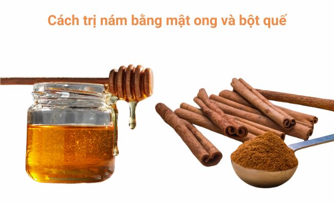 Cách trị nám bằng mật ong và bột quế