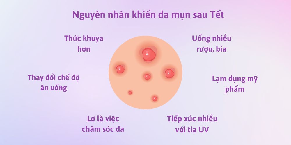Nguyên nhân khiến da mụn sau Tết
