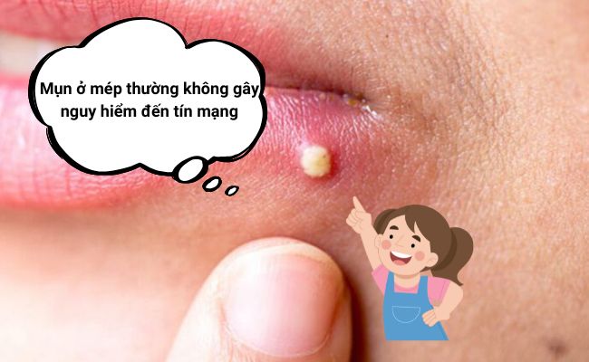 Mụn ở mép môi có nguy hiểm không?