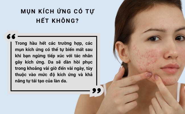 Mụn kích ứng có tự hết không?