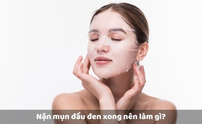 Nặn mụn đầu đen xong nên làm gì? Cách chăm sóc da sau khi nặn mụn