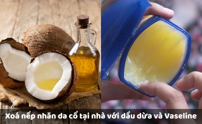 Cách xóa nếp nhăn ở cổ an toàn, đơn giản, hiệu quả nhất