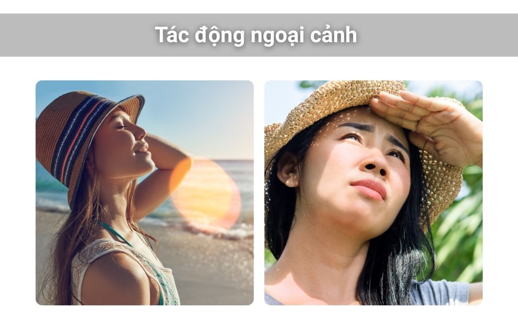 Da khó trắng do tác động ngoại cảnh