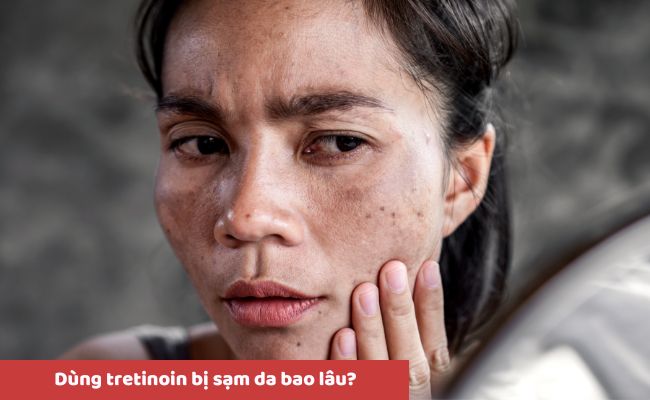 Một số câu hỏi liên quan đến Tretinoin