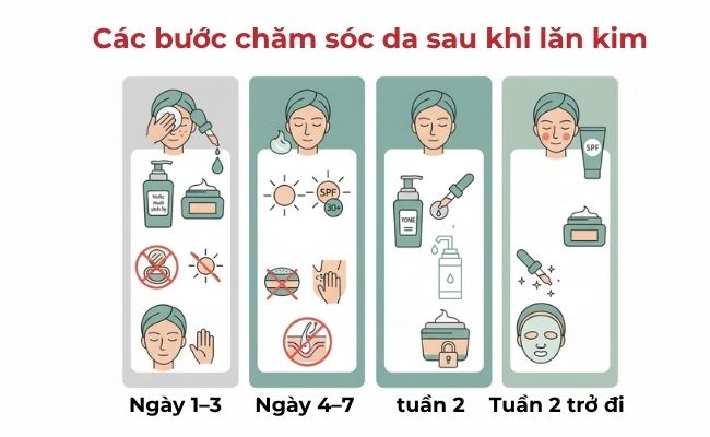 Hướng dẫn các bước chăm sóc da sau khi lăn kim