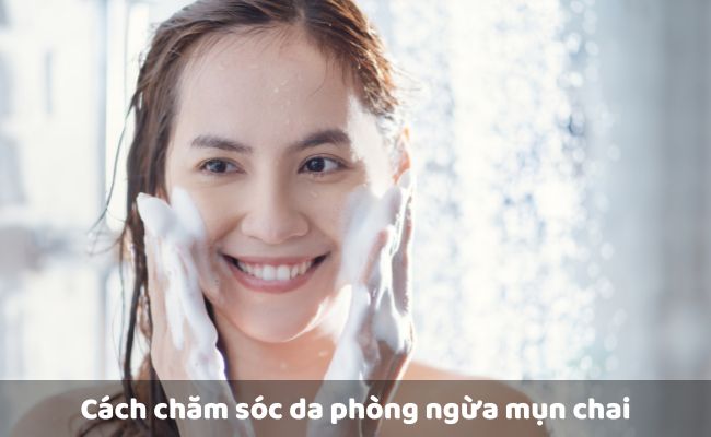 Cách chăm sóc da phòng ngừa mụn chai