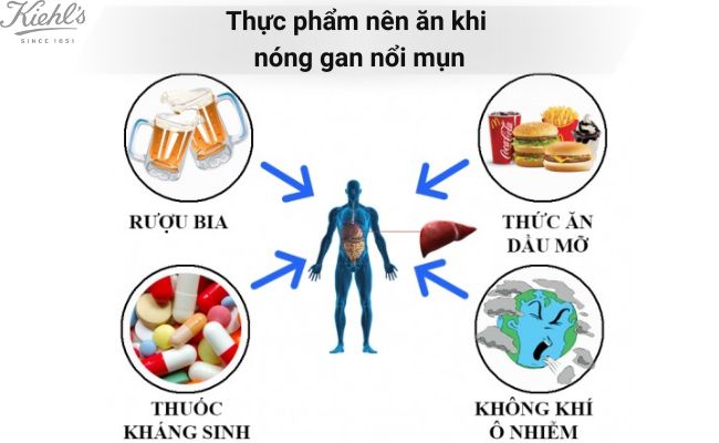 Thực phẩm nên ăn khi nóng gan nổi mụn