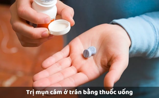 Trị mụn cám ở trán bằng thuốc uống