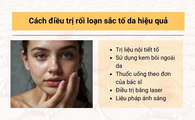 Cách điều trị rối loạn sắc tố da hiệu quả