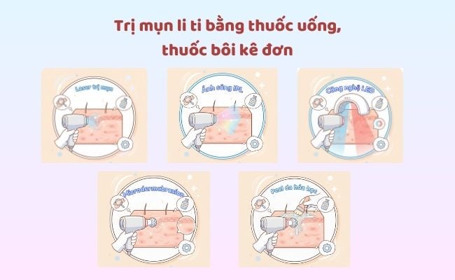 Trị mụn bằng liệu pháp công nghệ cao