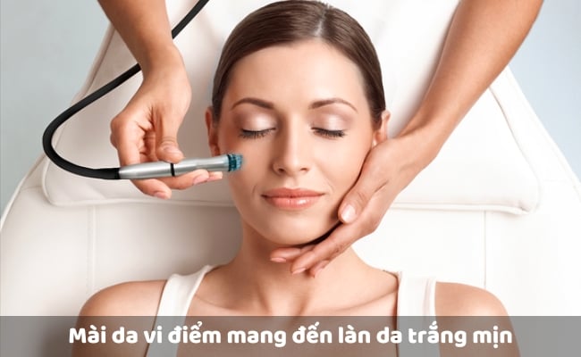 Mài da vi điểm mang đến làn da trắng mịn