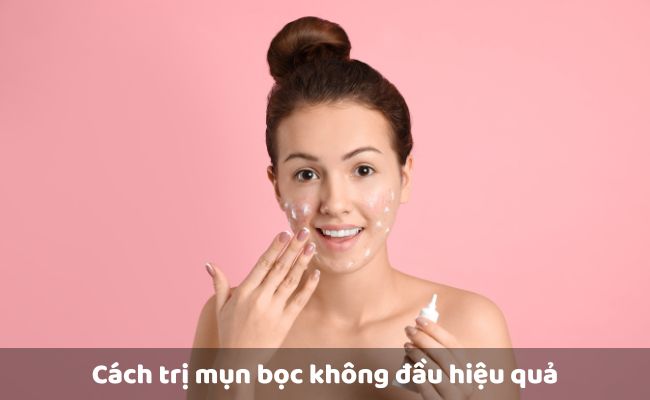 Trị mụn bọc không đầu bằng thuốc bôi không kê đơn (OTC)
  
  
  