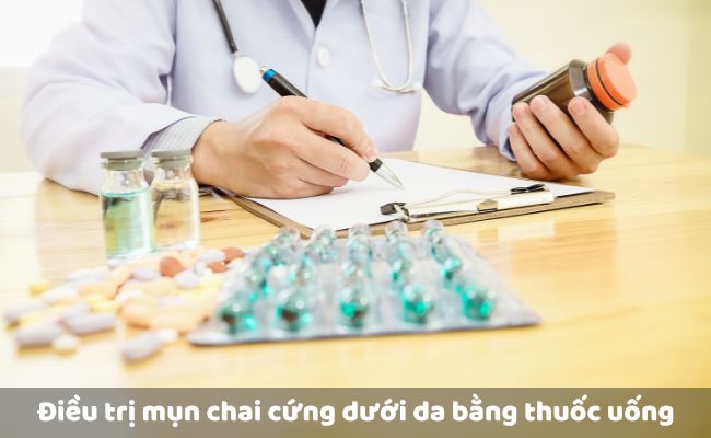 Điều trị mụn chai cứng dưới da bằng thuốc uống

