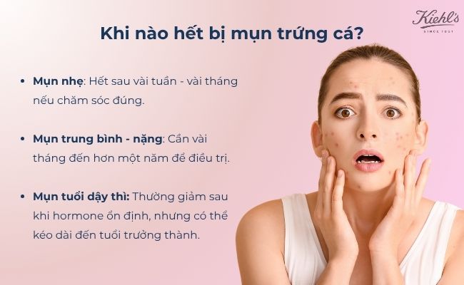 Khi nào hết bị mụn trứng cá?
