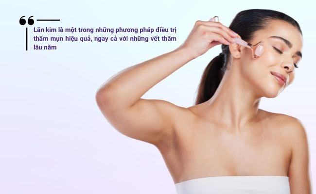 Lăn kim là một trong những phương pháp điều trị thâm mụn hiệu quả, ngay cả với những vết thâm lâu năm