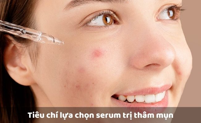 Tiêu chí lựa chọn serum trị thâm mụn