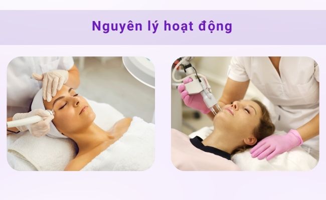 Laser phá hủy melanin, giúp làm mờ vết nám