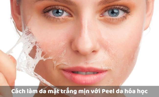 Cách làm da mặt trắng mịn với Peel da hóa học