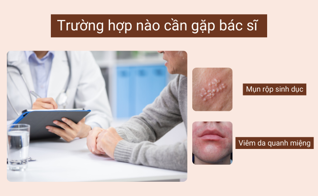 Khi bị mụn quanh miệng thì trường hợp nào cần gặp bác sĩ
