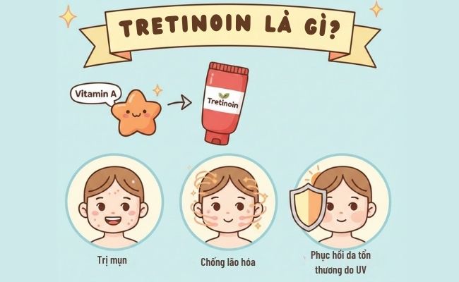 Tretinoin là gì?

