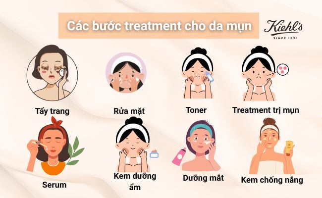 Các bước treatment cho da mụn đúng chuẩn