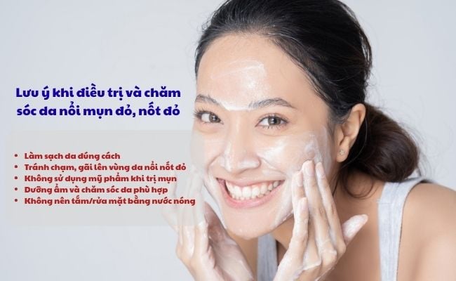 Lưu ý khi điều trị và chăm sóc da nổi mụn đỏ, nốt đỏ