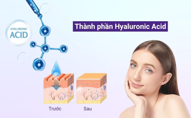 Tìm hiểu về thành phần HA