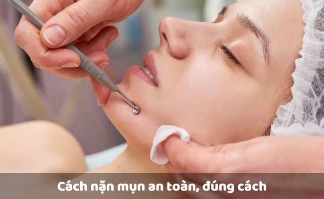 Cách nặn mụn an toàn, đúng cách