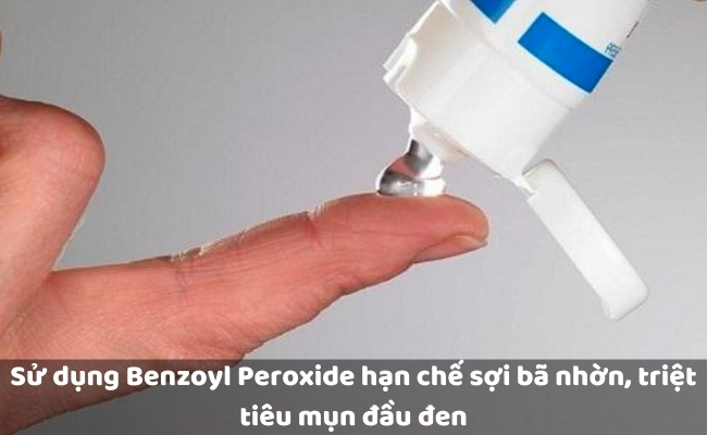 Sử dụng Benzoyl Peroxide hạn chế sợi bã nhờn, triệt tiêu mụn đầu đen